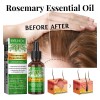 3pcs Hair Growth Aceite Esencial Romero 100% Puro Natural