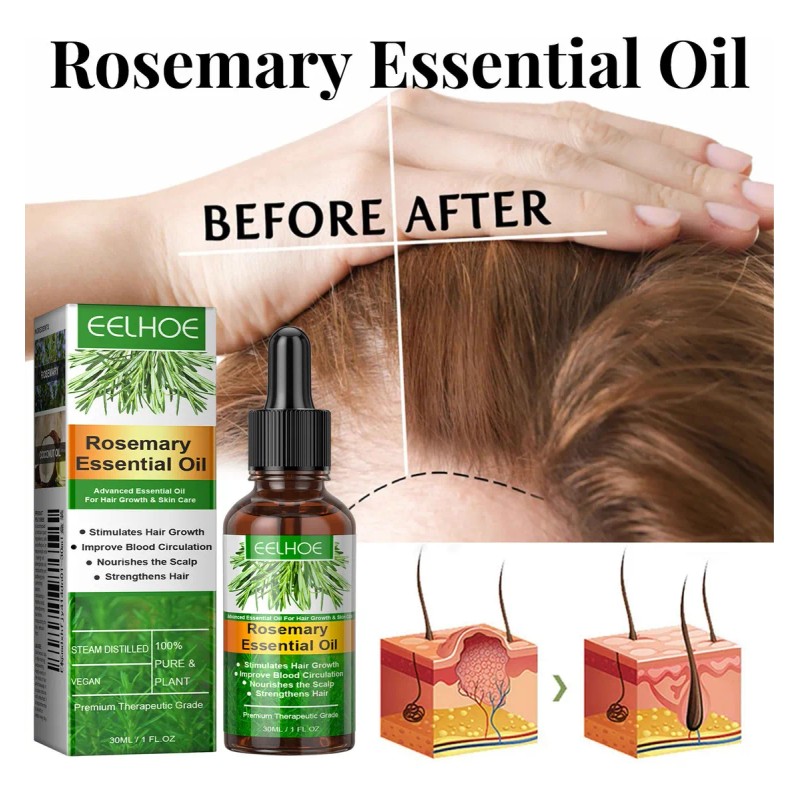3pcs Hair Growth Aceite Esencial Romero 100% Puro Natural