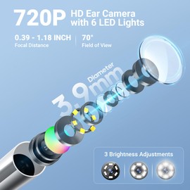 ScopeAround Otoscope with Light, 720P HD Ear Cleaning Camera & 6 LED Lights Ear Scope, Digital Otoscope with Camera, Smart Endoscope, Plug & Play, USB-C Port