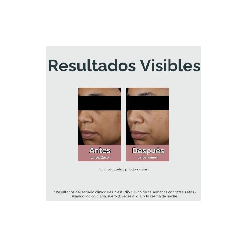 Eucerin Crema de noche Radiant Tone Corrector de manchas oscuras