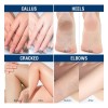 Urea Cream 42% Plus Salicylic Acid 2% Net 350g For