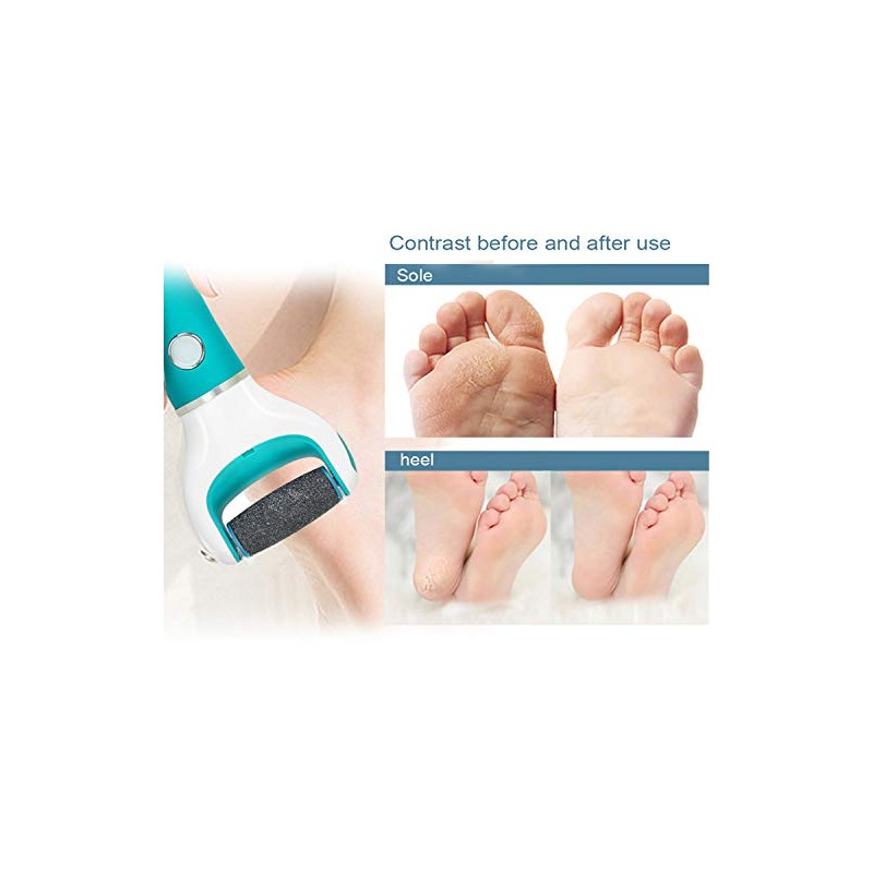 CANVALITE 9Pcs Pedi Replacement Rollers Heads Refills, 5 Extra Coarse