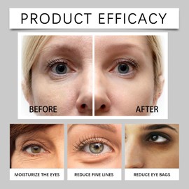 60PCS Hydrogel Under-Eye Patches for Dark Circle and Puffiness Reduction, Moisturising & Refreshing Gel Eye Mask Treatment,Natural and Gentle Hydrating Under-Eye Pads, Anti-Wrinkle Eye Gel Pads