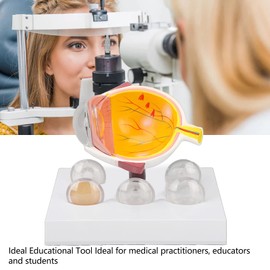 Human Eye Model Anatomy,Shows Optic Details Eyeball Anatomical Model,Glaucoma Medical Eye Ball Model for School Clinic
