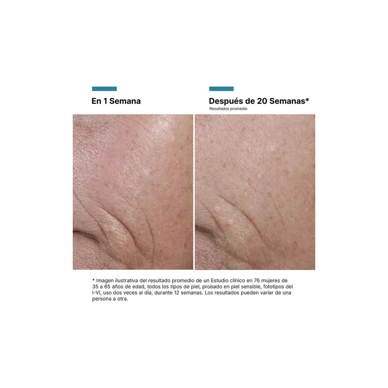 Skinceuticals Age Interrupter Ultra Serum 30 Ml