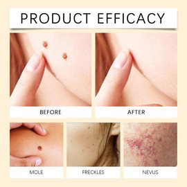 Bienengift Umfassende Creme, 60g Bienengift Hautpflegecreme, Natürliches Bienengiftsalbe für alle Hauttypen