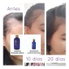 Shampoo Anticaida Para El Cabello Terramiracle Terramar