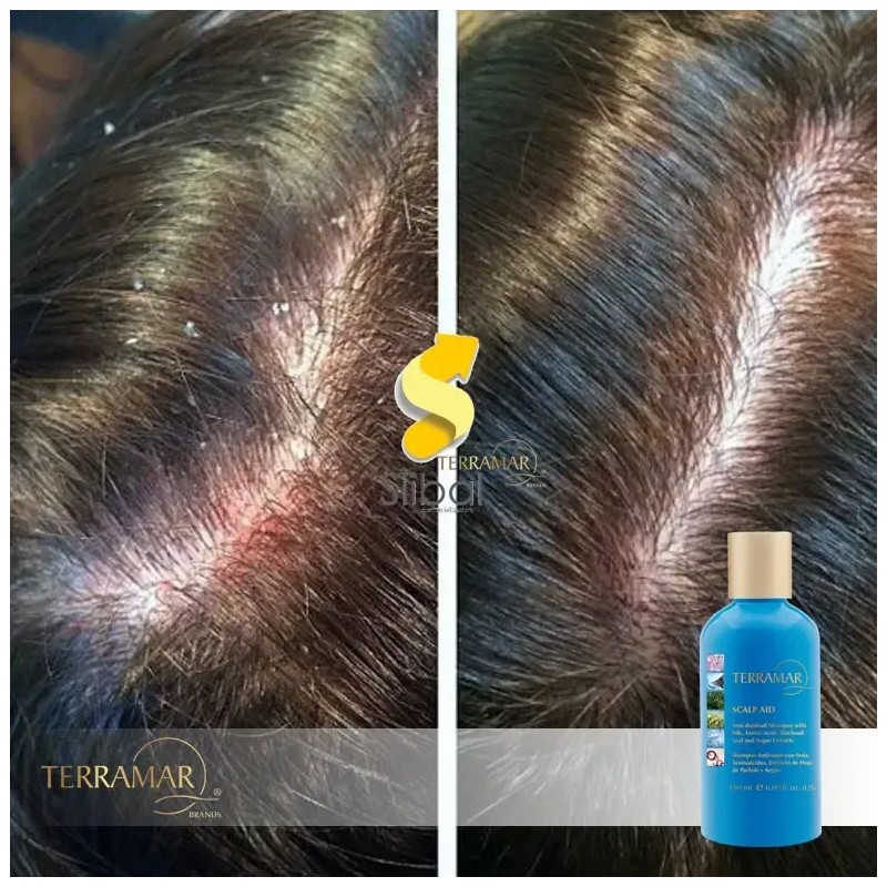 Shampoo Anticaspa Con Seda, Pachuli, Argán Terramar / 180 Ml