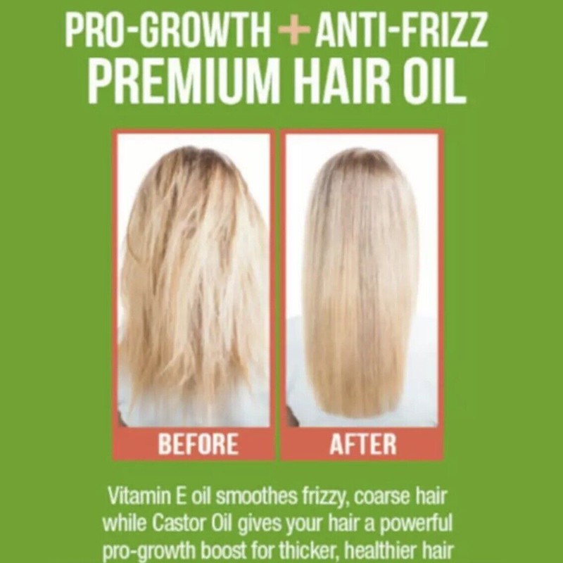 Difeel Castor Plus Vitamin E - Pro-Growth+Ant