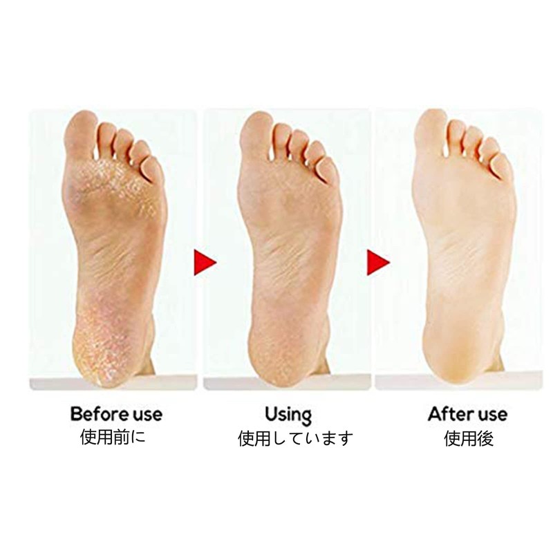 UNG Exfoliating Heel Exfoliating Heel Care, Exfoliating Double-sided, Heel File,