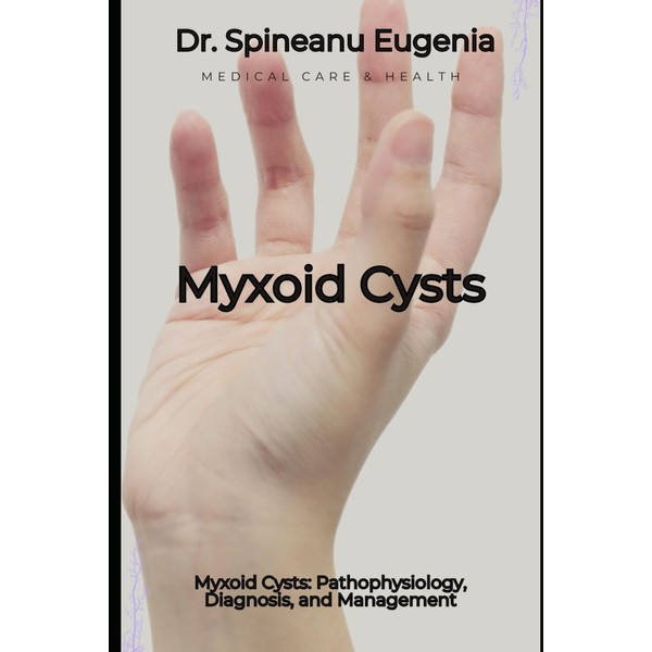 Myxoid Cysts: Pathophysiology, Diagnosis, and Management
