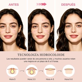 Parches para Acne 320 Piezas, Pimple Patch Estrellas para Granos