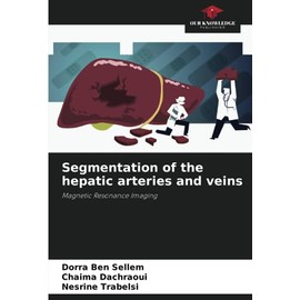 Segmentation of the hepatic arteries and veins: Magnetic Resonance Imaging