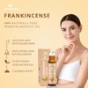 Frankincense Essential Oil Roll On, 100% Pure and Natural Frankincense