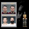Aceite De Barba 6pcs Cuidado De Belleza De Suavización De