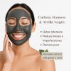 Mascarilla Facial Spa Con Arcilla Y Carbón Piel Grasa 1.4kg