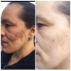 Jacvon LLC Skin Lightener Cream: Para Piel Morena o India