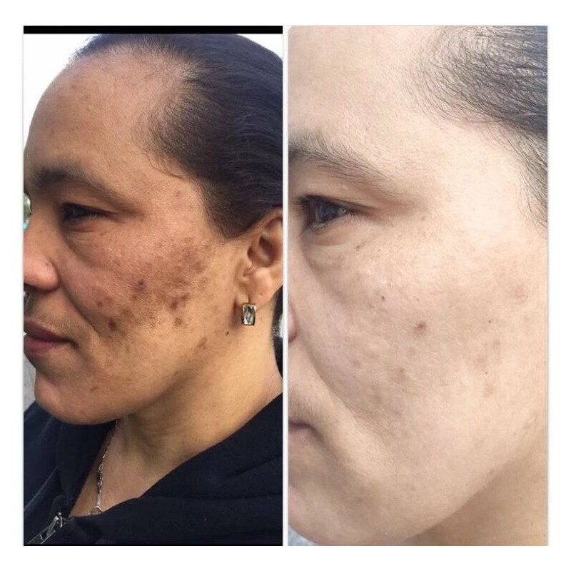 Jacvon LLC Skin Lightener Cream: Para Piel Morena o India