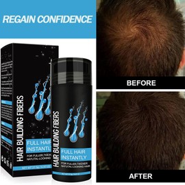 Hair Fibres Dark Brown, Hair Fibers for Men, Professional Quality Fiber Hair Powder for Women and Men for Bald Spots & Thinning Hair Filler Instantly 27.5g Bottle(Dark Brown)