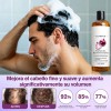 2pzs Shampoo Lexenic Excalvo Con Cebolla Y Aceite De Romer