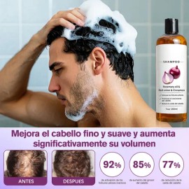 2pzs Shampoo Lexenic Excalvo Con Cebolla Y Aceite De Romer                                                                                            