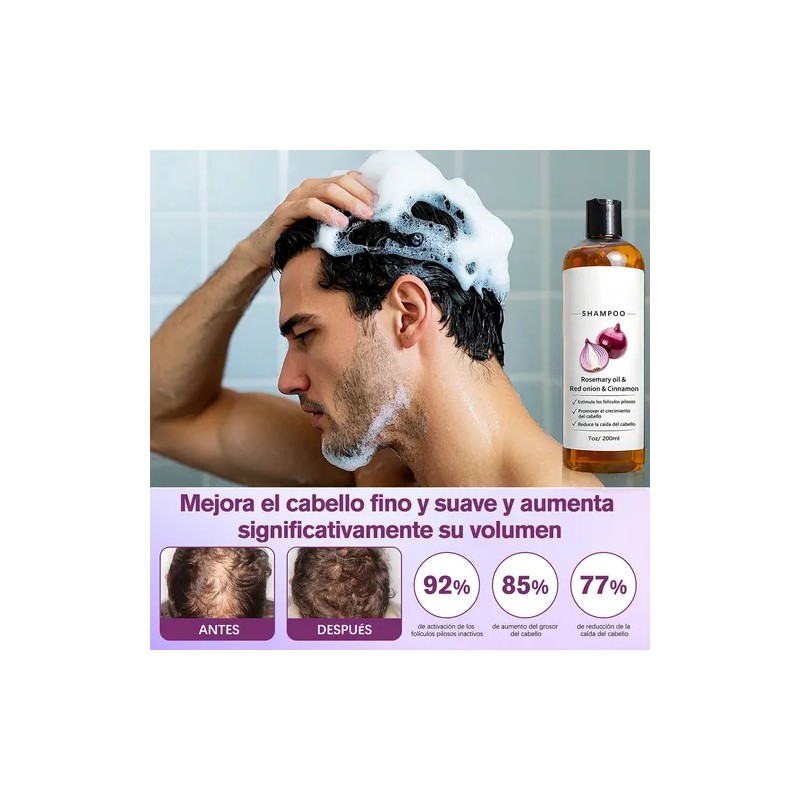 2pzs Shampoo Lexenic Excalvo Con Cebolla Y Aceite De Romer