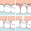 TePe Bridge und Implant Floss