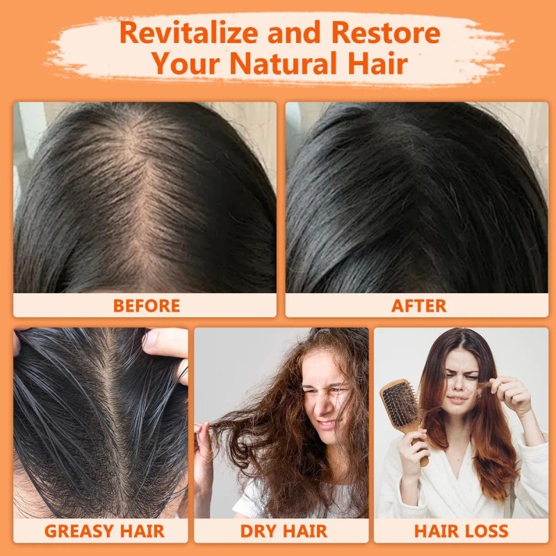"Aceite de Batana para Crecimiento del Cabello – Tratamiento Natural