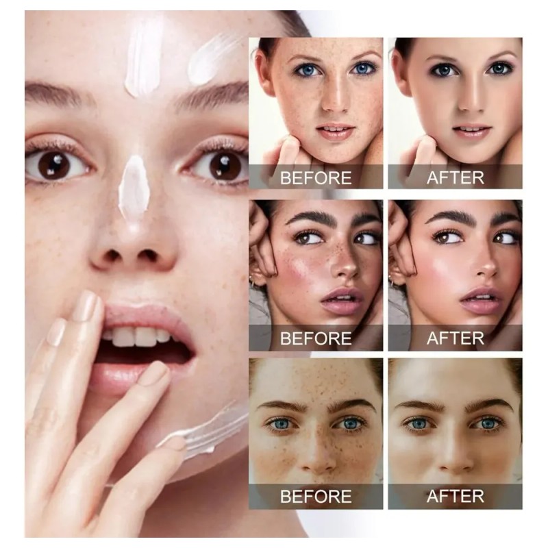 Crema Facial Despigmentante Y Anti Manchas Pack 2 Pzs Todo