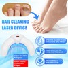 LEEWENYAN Nail Fungus Treatment Device, Highly Efficient Nail Fungus Cold