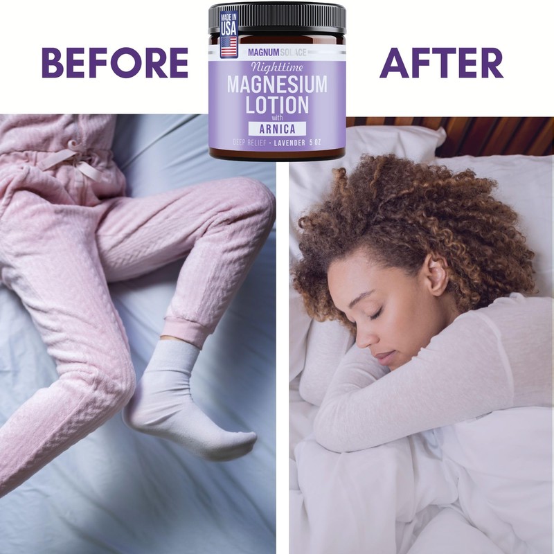 Magnum Solace Nighttime Magnesium Lotion with Arnica – Highly Concentrated