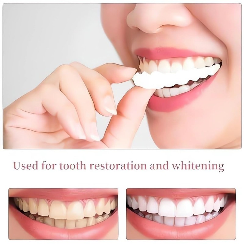 2 Pairs, Temporarily Adjustable for Men and Women, Beautiful Smile