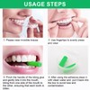 Pack of 10 Aligner Chewies Aligner Tray Seater Chewies Green