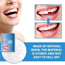 Temporary Tooth Repair Kits,Treval Size Temporary Tooth Filling Kit,False Teeth Replacement Repair Beads,Easy & Qucik Moldable False Teeth,Thermal Forming DIY Tooth Repair Granules,Dental Bridge