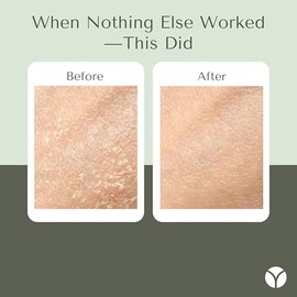 Crema hidratante para rostro y cuerpo para pieles secas y sensibles | Extractos probióticos, miel, cúrcuma, vitamina B12, ceramidas, manteca de karité