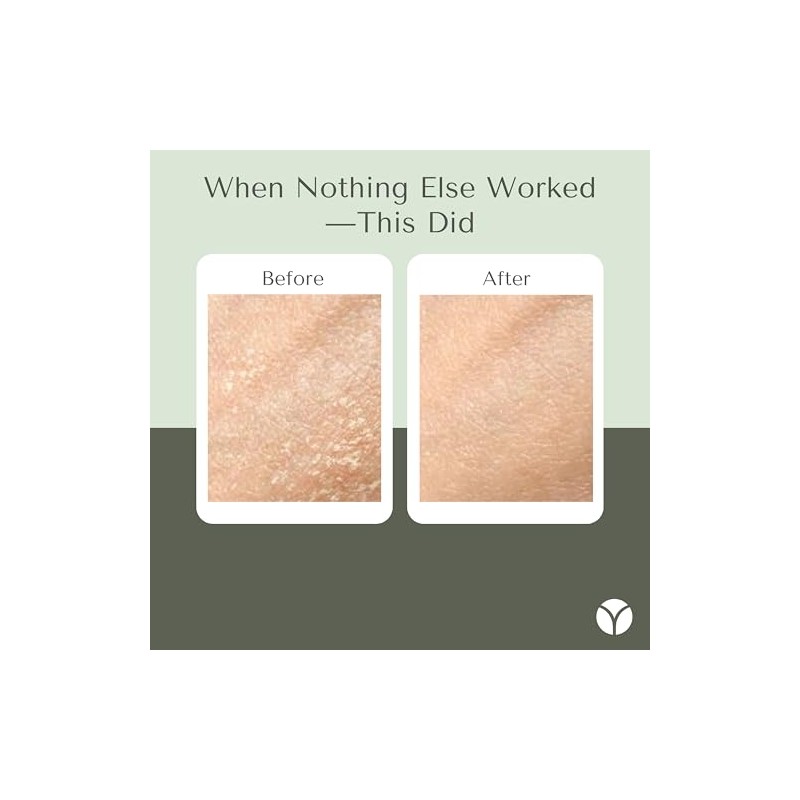 Crema hidratante para rostro y cuerpo para pieles secas y
