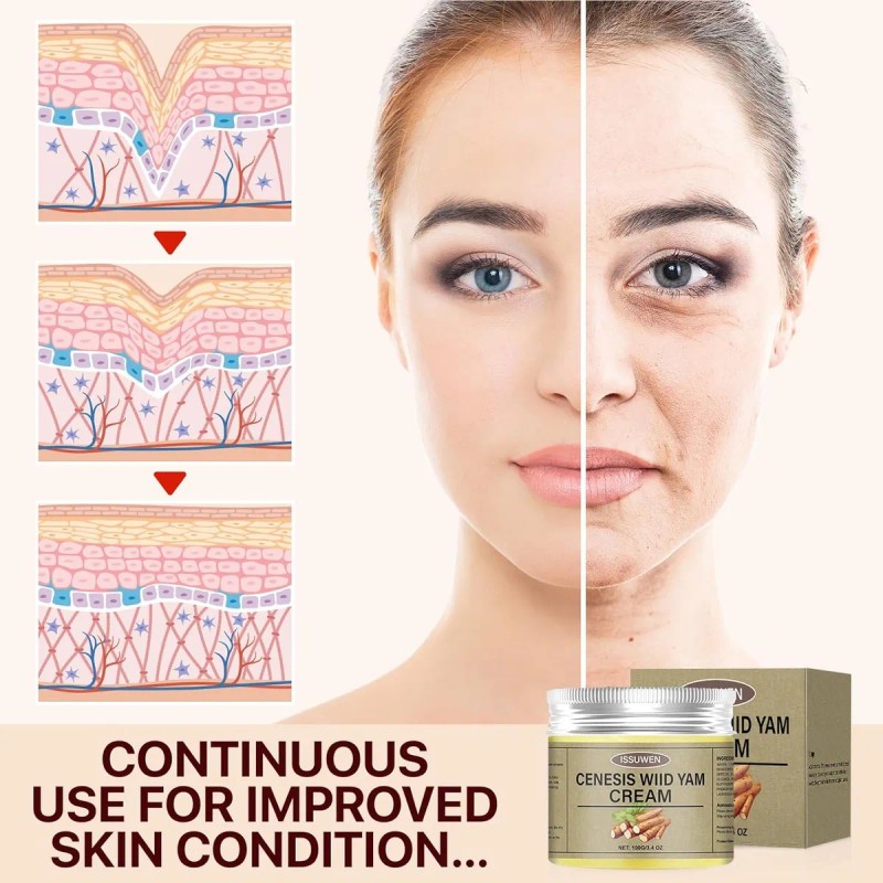 Crema De Ñame Silvestre Para Mujeres, Mantequilla Corporal D