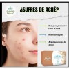 5 Pack Jabón Avena Sheló Nabel Irritación Exceso De Grasa