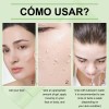 Gel Exfoliante Purificante Facial Eliminar Acné Cabeza Negra
