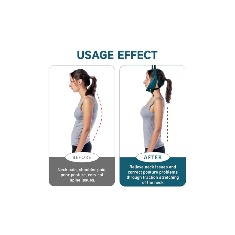 2026 Upgraded Neck Stretcher Cervical Traction Device for Decompression Home