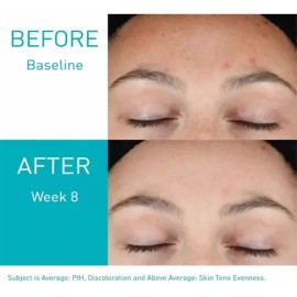 Serum Retinol Anti-marcas Con 3 Ceramidas 30ml Cerave