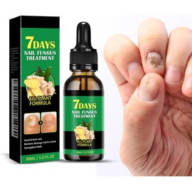 7 días de tratamiento de uñas de jengibre, ginger nail suero crecimiento de la uña de suero cuidado de la cutícula de jengibre aceite de uñas de jengibre para las uñas fortalecidas