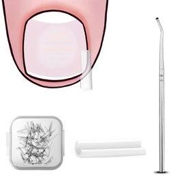 Norhogo Set zur Korrektur eingewachsener Zehennägel, 50 Stück schmerzfreie Zehennagelglättungsstreifen für Eingewachsener Zehennägel mit Nagelpicker, für Fußpflege Behandlung