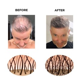 Hair Fibres by Keratech Pro 12ml | Instantly Fuller Hair | Advanced 100% Natural Keratin formula (Black)