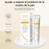 Crema Para Eliminar Cicatrices Quirúrgica Crema Para Estrias