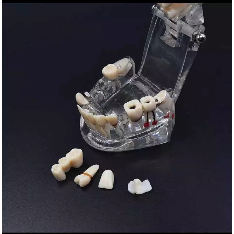 YouDental Tipodonto De Tratamientos Dentales