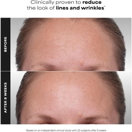 Paula's Choice Clinical 1% Retinol Treatment with Peptides & Vitamin C for Deep Wrinkles - 0.16 oz
