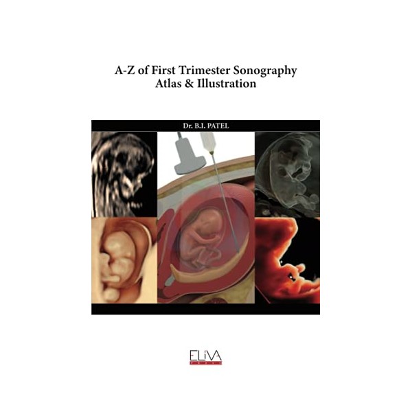 A-Z of First Trimester Sonography Atlas & Illustration