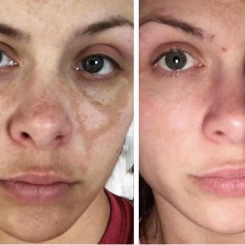 crema Carotone 135ml anti dark spot Clean Face