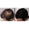 LUXE Professional Hair Thickening Fibers - CONFIDENCE IN A JAR